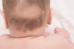 Trẻ em bị rụng tóc: Nguyên nhân và cách khắc phục