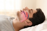 5 cách khắc phục chứng ngưng thở khi ngủ để có giấc ngủ ngon