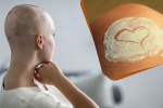 Làm sao khắc phục tình trạng da khô do hóa trị ung thư?