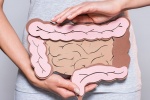 Video: Mắc hội chứng ruột kích thích không nên ăn gì?