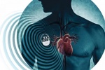 Những lưu ý để có thể chung sống với máy tạo nhịp tim