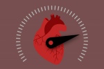 Rối loạn nhịp tim nhanh trên thất: Một nguyên nhân làm tim đập nhanh