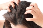4 biện pháp tự nhiên trị ngứa da đầu hiệu quả tại nhà