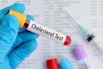 4 khám phá mới giúp bạn hiểu hơn về cholesterol