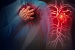 Hẹp động mạch phổi: Căn bệnh nguy hiểm có thể dẫn tới suy tim