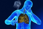 Hút thuốc lá liên quan tới 6/8 nguyên nhân gây tử vong hàng đầu