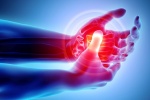 Viêm khớp ngón tay cái: Triệu chứng, nguyên nhân và cách điều trị