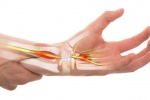 Bệnh suy giáp làm tăng nguy cơ mắc hội chứng ống cổ tay?