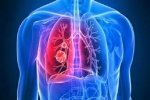 Những dấu hiệu cảnh báo xơ phổi vô căn có thể bạn không biết