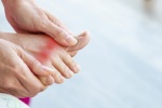 Giải pháp nào ngăn ngừa biến chứng bệnh gout?