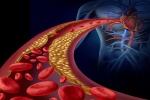 Tăng huyết áp vô căn: Căn bệnh âm thầm mà nguy hiểm!