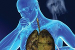 Nên và không nên ăn gì để phòng ngừa ung thư phổi?