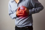 Hẹp mạch vành: Uống thuốc vẫn đau tức ngực phải làm sao?