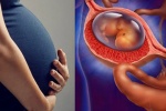 Dấu hiệu nhận biết sớm mang thai ngoài tử cung
