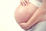 Mách mẹ bầu cách ngăn rạn da khi mang thai