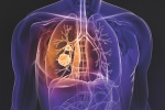 Điều trị ung thư phổi tế bào nhỏ như thế nào? 