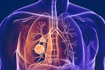 ung thư phổi di căn nên làm gì để kéo dài thời gian ổn định bệnh?