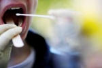 Khô miệng, ngứa lưỡi có thể là triệu chứng mới cảnh báo COVID-19?