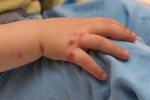 Trẻ bị tay chân miệng có nên dùng kháng sinh không? 