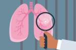 Những đối tượng nguy cơ cao, cần sớm tầm soát ung thư phổi 