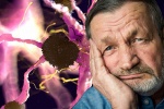 Người bệnh Parkinson và triệu chứng mất khả năng biểu cảm trên khuôn mặt