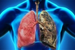 Ung thư phổi chia làm mấy giai đoạn?