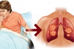 6 dấu hiệu cảnh báo phổi của bạn đang “kêu cứu”