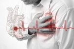 Người bị tai biến và suy tim điều trị thế nào?