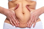 Mẹo giúp khắc phục tình trạng da bụng nhăn nheo, chảy xệ sau sinh