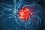 Tổng quan về bệnh tim thiếu máu cục bộ: Triệu chứng, điều trị thế nào?