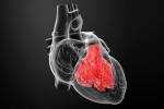 Bệnh tim to và cách điều trị ngăn biến chứng suy tim, đột tử