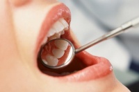 5 loại thực phẩm giúp bạn ngăn ngừa các bệnh về nướu