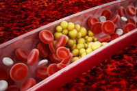 'Điểm danh' những loại quả quen thuộc giúp làm giảm cholesterol