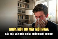 Hắt xì hơi liên tục, ngứa mắt: Có phải viêm mũi dị ứng?