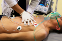 Sự thật về đột quỵ khi chơi thể thao