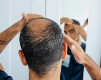 Nam giới bị rụng tóc nên ngừng loại đồ uống nào?