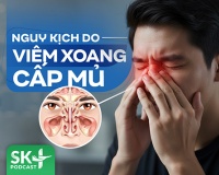 Podcast: Nguy kịch do viêm xoang cấp mủ