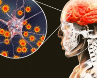 Bệnh viêm não mô cầu diễn biến phức tạp, Bộ Y tế cảnh báo