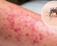 Bộ Y tế: Nguy cơ gia tăng dịch bệnh dịp sát Tết