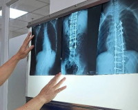Chụp X-quang không đủ 6 phút bị từ chối thanh toán BHYT, Bộ Y tế vào cuộc