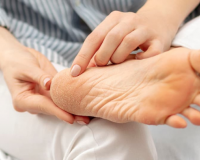 Cải thiện tình trạng nứt nẻ gót chân trong 4 bước