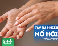 Podcast: Hay bị đổ mồ hôi tay có cách nào để cải thiện?