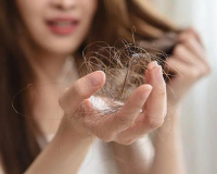 Căng thẳng có thể gây rụng tóc?