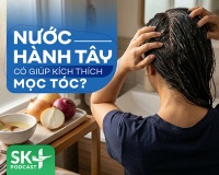 Podcast: Nước hành tây có giúp kích thích mọc tóc?