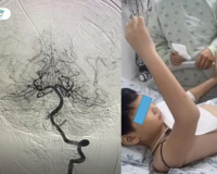 Bé trai 10 tuổi suýt liệt nửa người sau khi đi chơi cầu lông