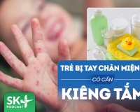 Podcast: Trẻ bị tay chân miệng có phải kiêng tắm không?