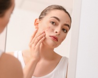 Infographic: Tại sao người trưởng thành vẫn có thể bị mụn?