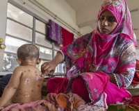 Bangladesh: Gần 100 trẻ em tử vong nghi do dịch sởi bùng phát