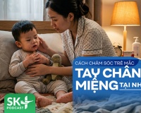 Podcast: Cách chăm sóc trẻ mắc tay chân miệng tại nhà