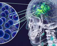 4 trường hợp tử vong do mắc viêm não mô cầu, Bộ Y tế phát cảnh báo